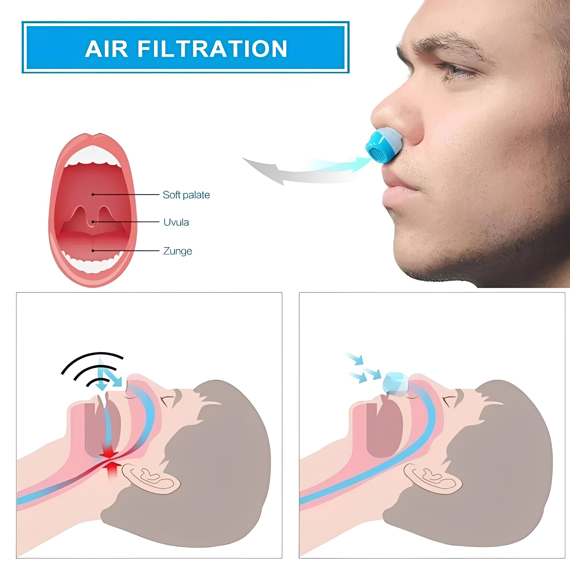 Air-Flow Nasal Insert: Cordless Snore-Support Device for Natural Breathing